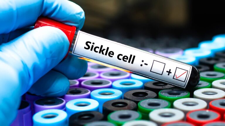 107377453 1708696168205 gettyimages 1824452072 sicklecell